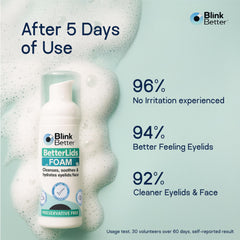 BlinkBetter BetterLids close-up showing hydrated eyelid skin.