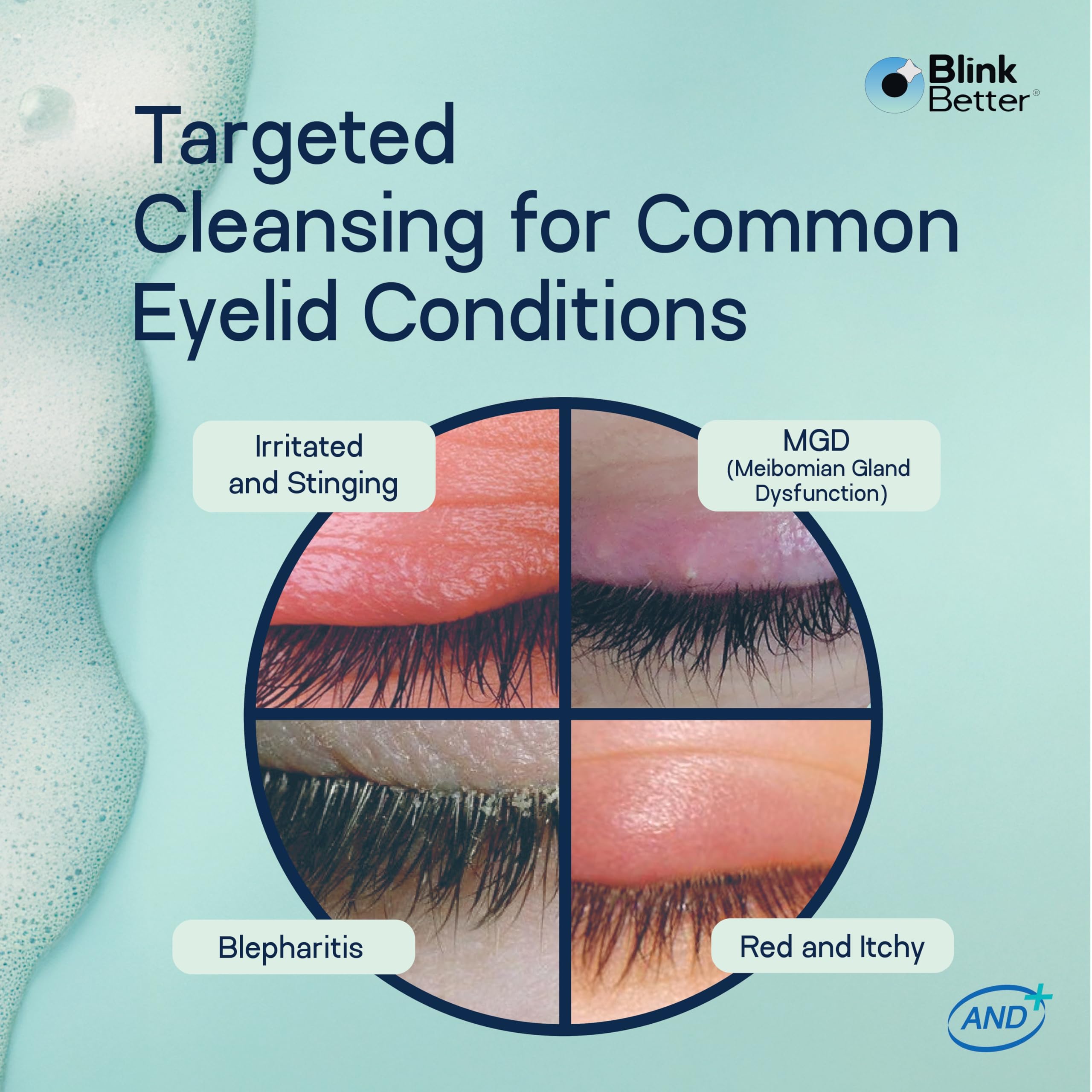 BlinkBetter BetterLids packaging highlights preservative-free formula.