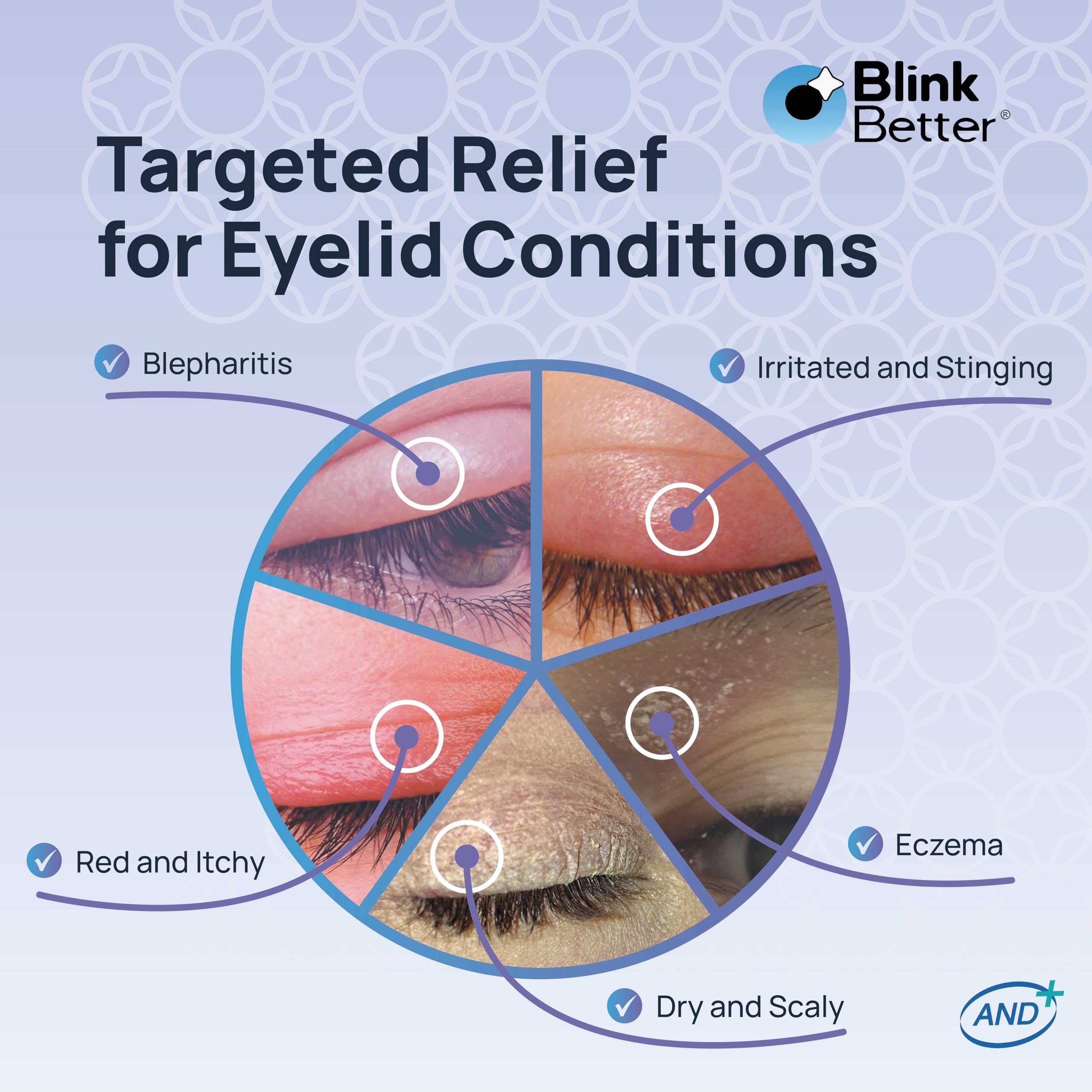 BlinkBetter BetterLids panthenol vitamin B5 benefits for moisture retention