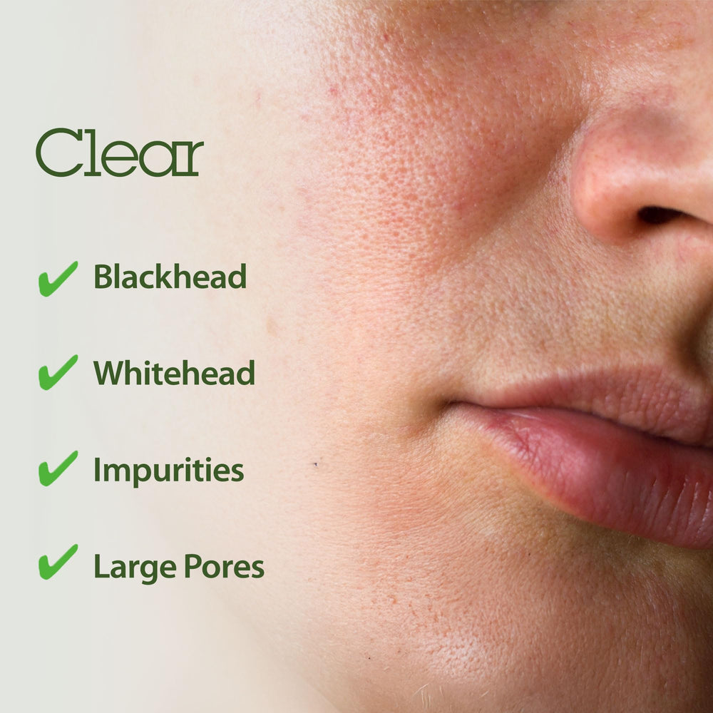 BLITHE exfoliation with AHA/BHA buffs dead skin for smoother texture.