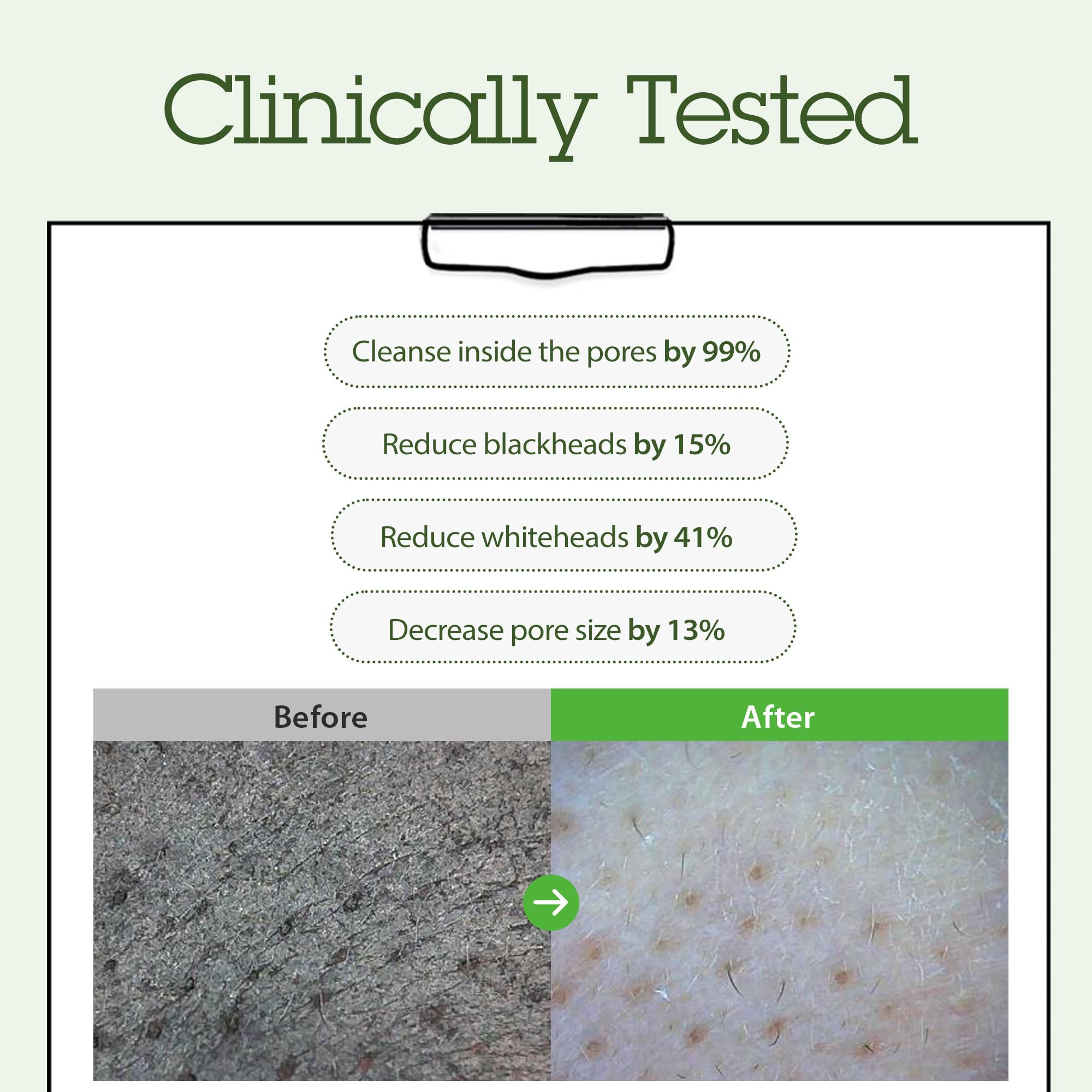 BLITHE pore-care results highlight smoother skin after use.