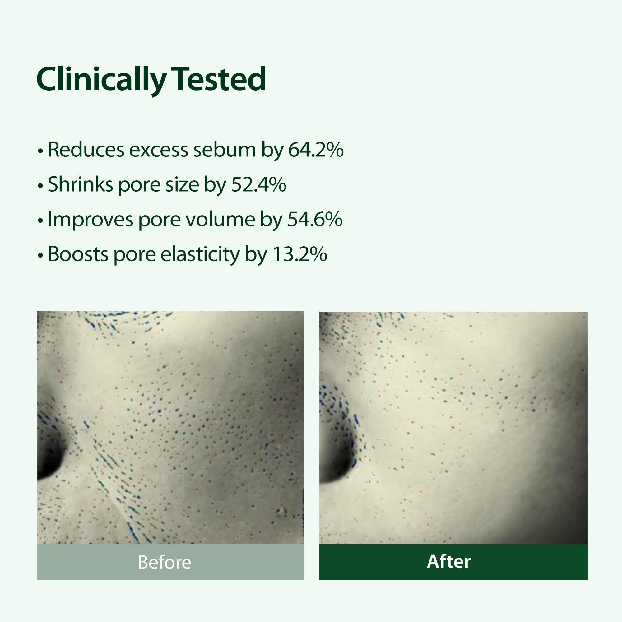 BLITHE Targeted Pore Serum gift-ready packaging for gifting.