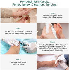 Blizzard toenail clippers chequered ergonomic handles reduce fatigue