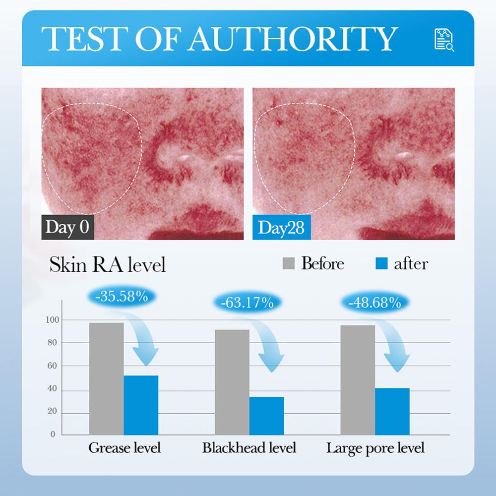 Blopuivo Pore Cleansing close-up highlights removal of impurities.