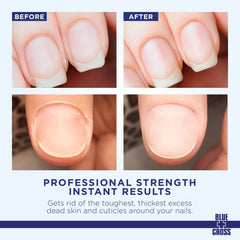 Blue Cross Cuticle Remover liquid application shows instant softening around nail beds.