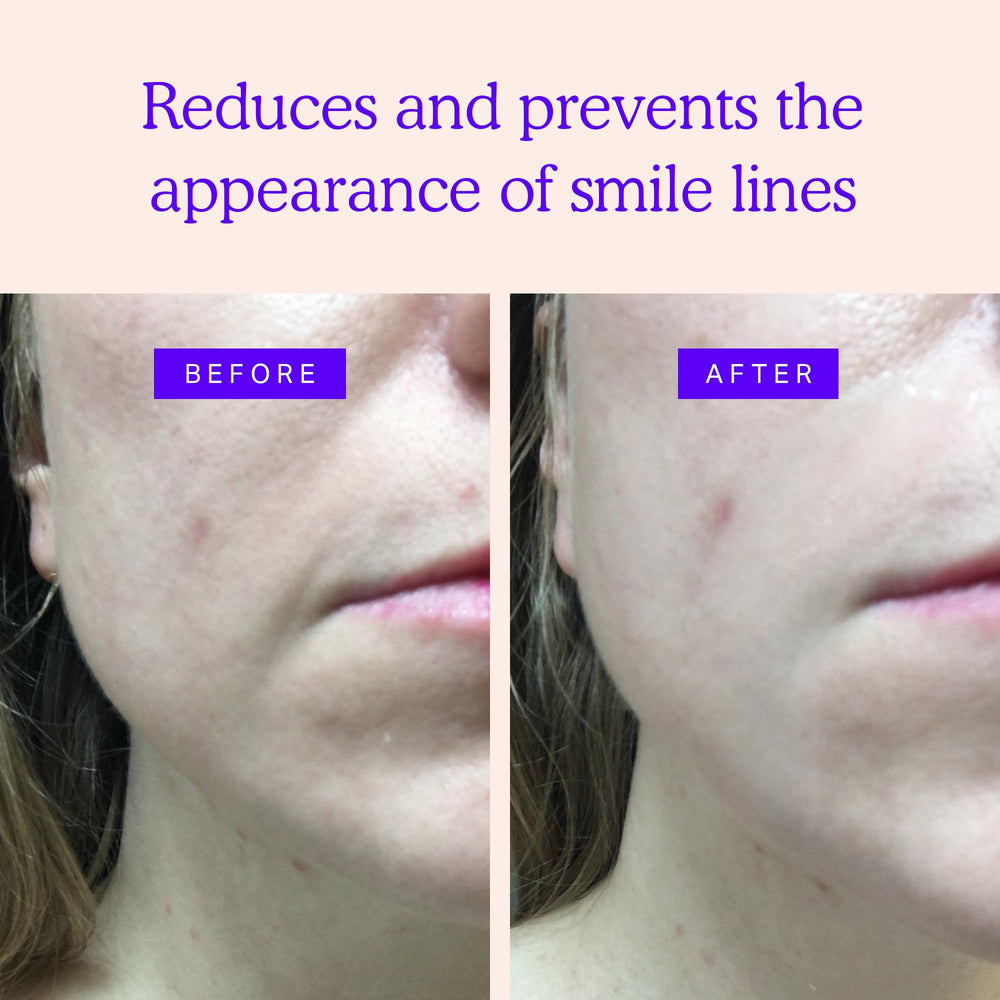 BLUMBODY face patches overnight application demonstrates skin-friendly non-transdermal use