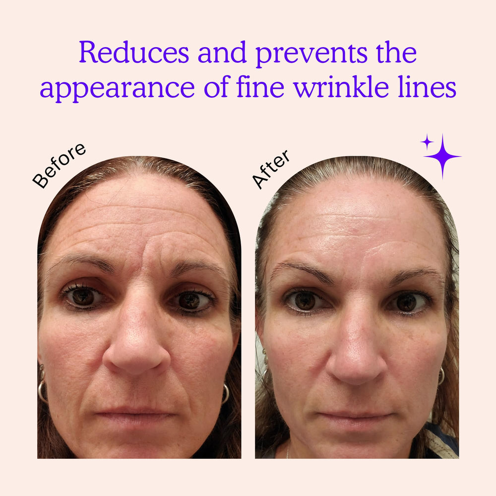 BLUMBODY forehead patch on skin highlights non-silicone, comfortable wear for forehead lines.