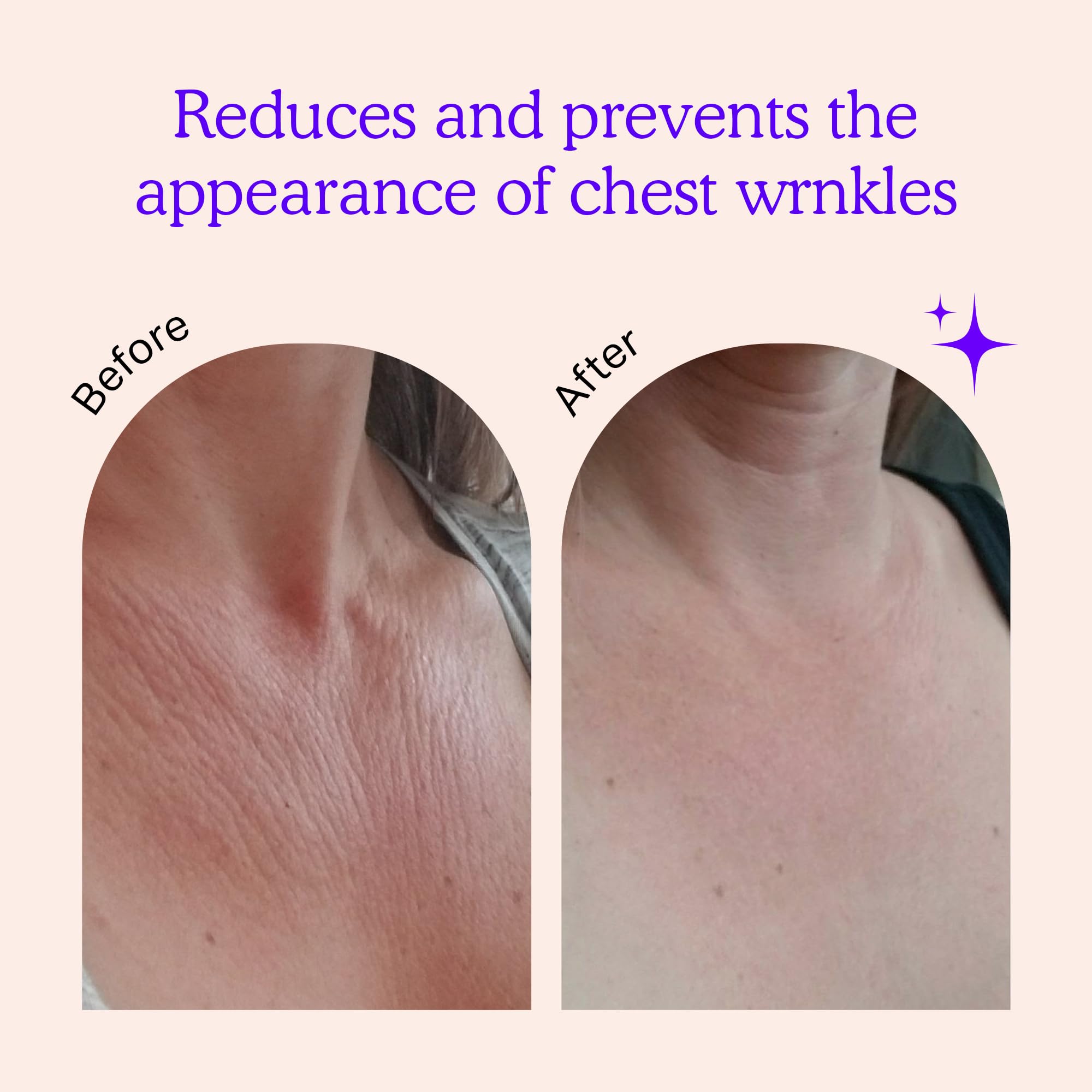 BLUMBODY Chest Wrinkle Pads closeup application showing soft silicone comfort.