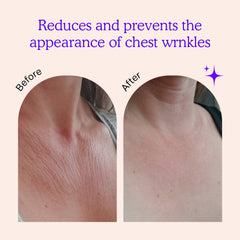 BLUMBODY Chest Wrinkle Pads closeup application showing soft silicone comfort.