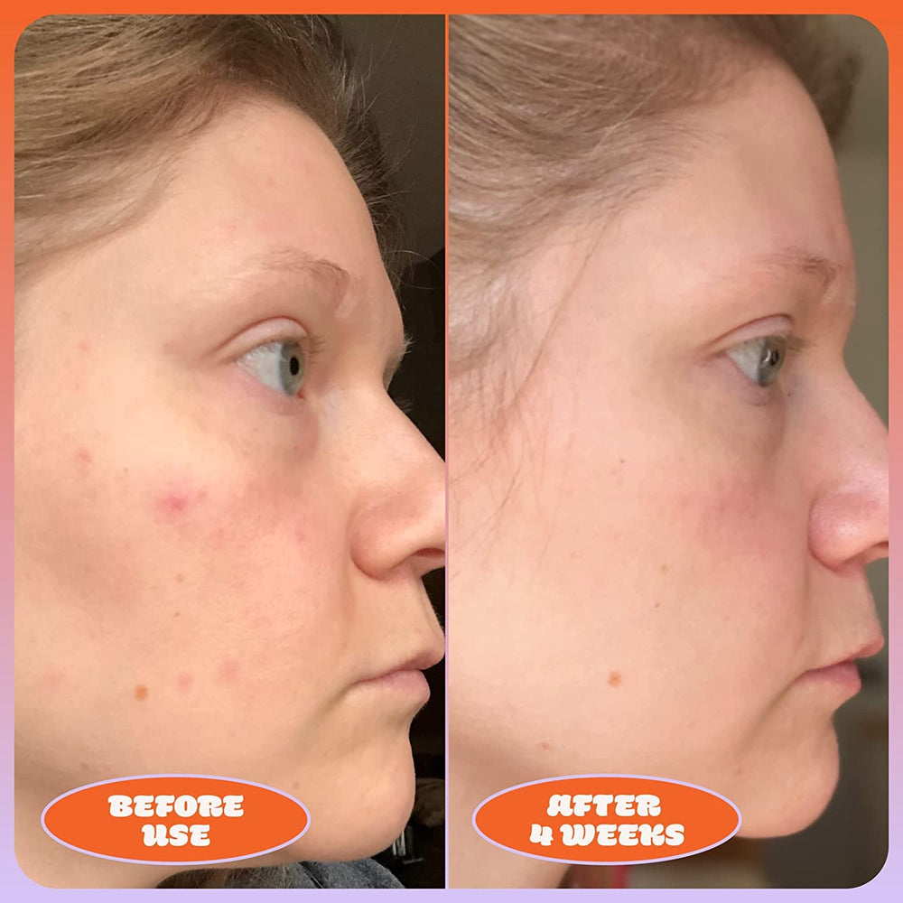 Blume Milky Fade serum ingredients glow with vitamin C, niacinamide, and hyaluronic acid