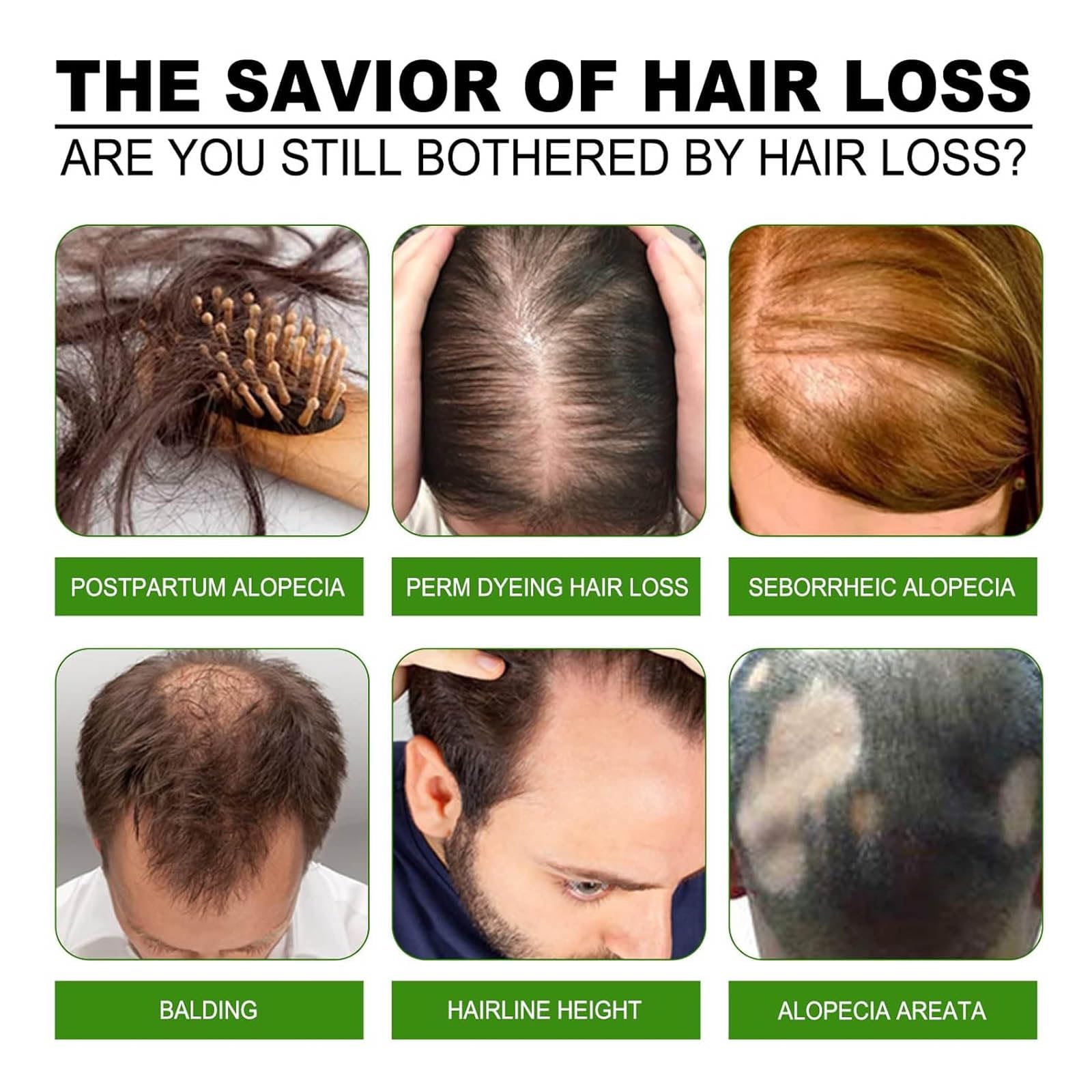 Boaccy Hair Regrowth System being massaged into scalp