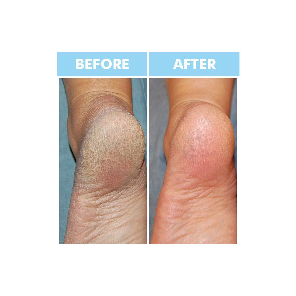 Bodipure Hand Mask application demonstrates easy wear and 20 minute treatment