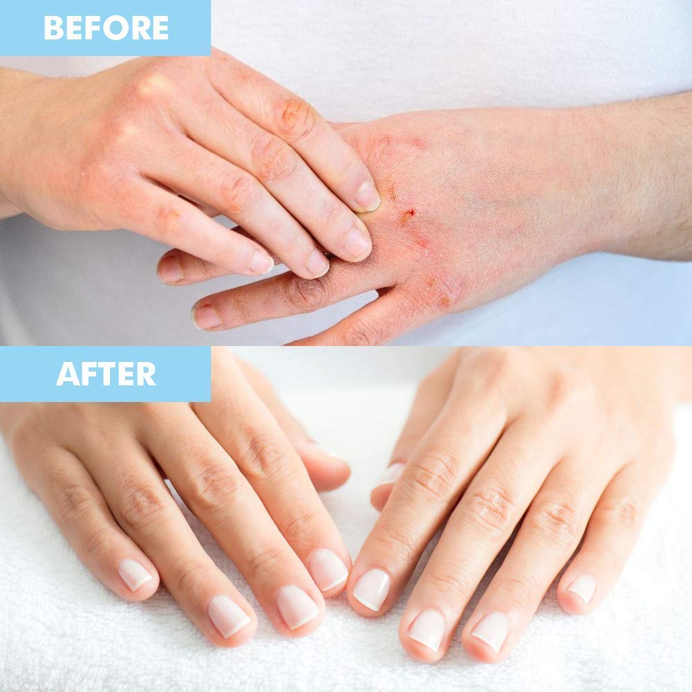 Bodipure Packaging 6+6 pack highlights the value bundle for hands and feet