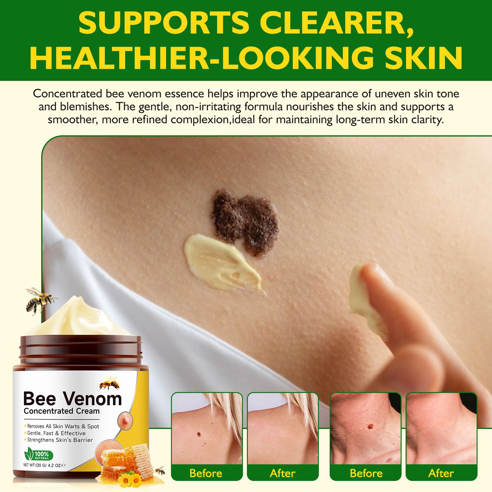 BOIUOITI Bee Venom Comprehensive Cream applied on face shows smoothing and even-toned look.