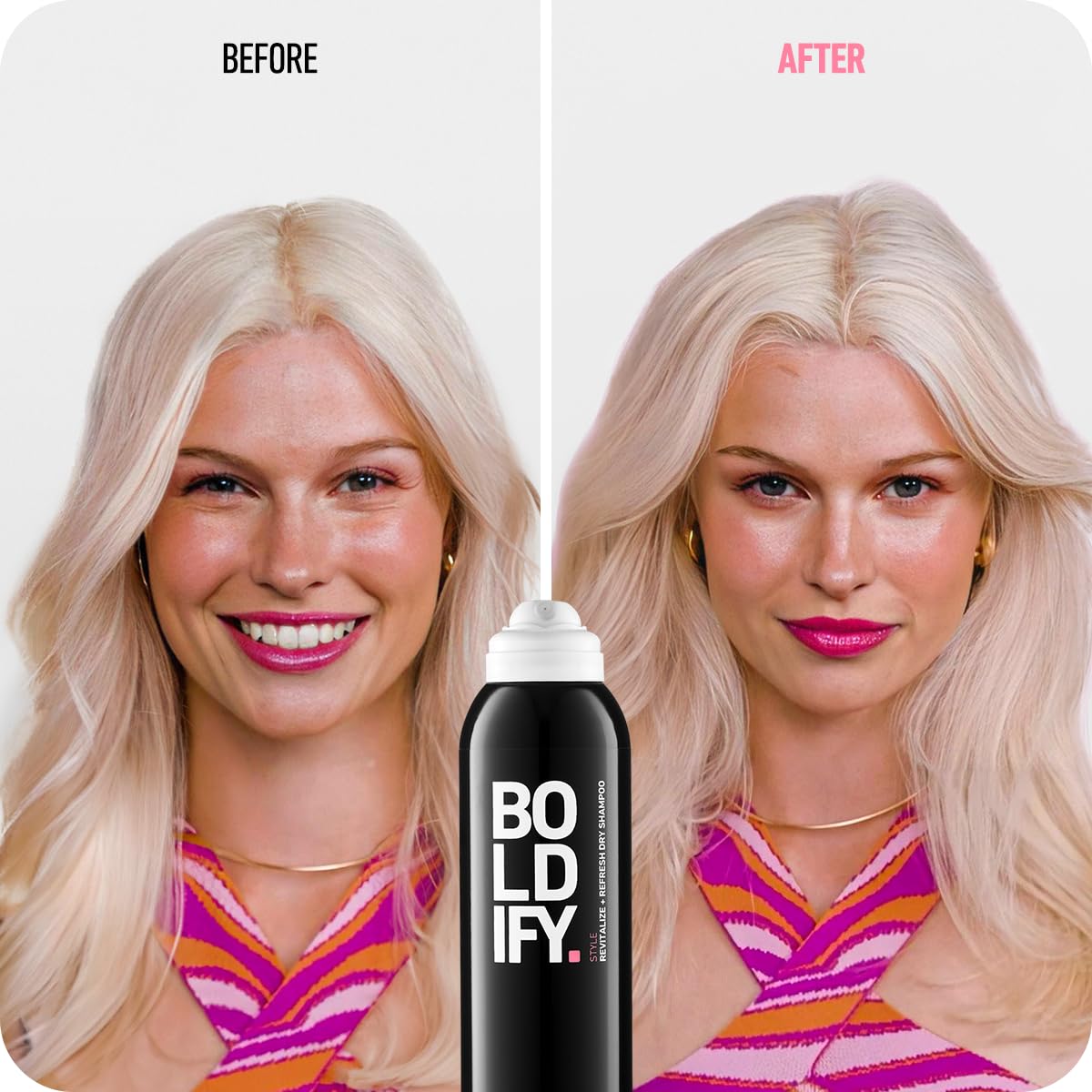 Boldify Dry Shampoo Spray emphasizing Scalposine blend for scalp nourishment and odor control