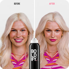 Boldify Dry Shampoo Spray emphasizing Scalposine blend for scalp nourishment and odor control