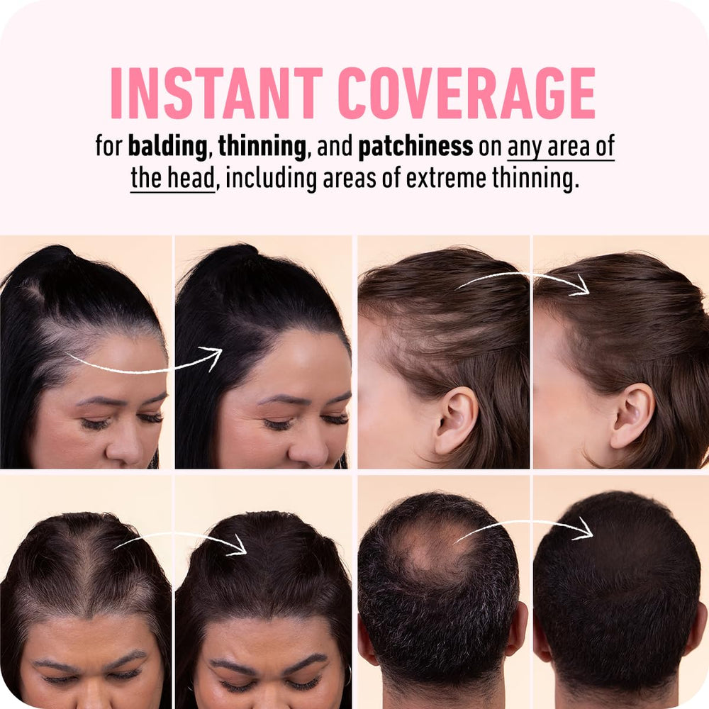Boldify Hairline Powder applied near hairline for seamless blend.