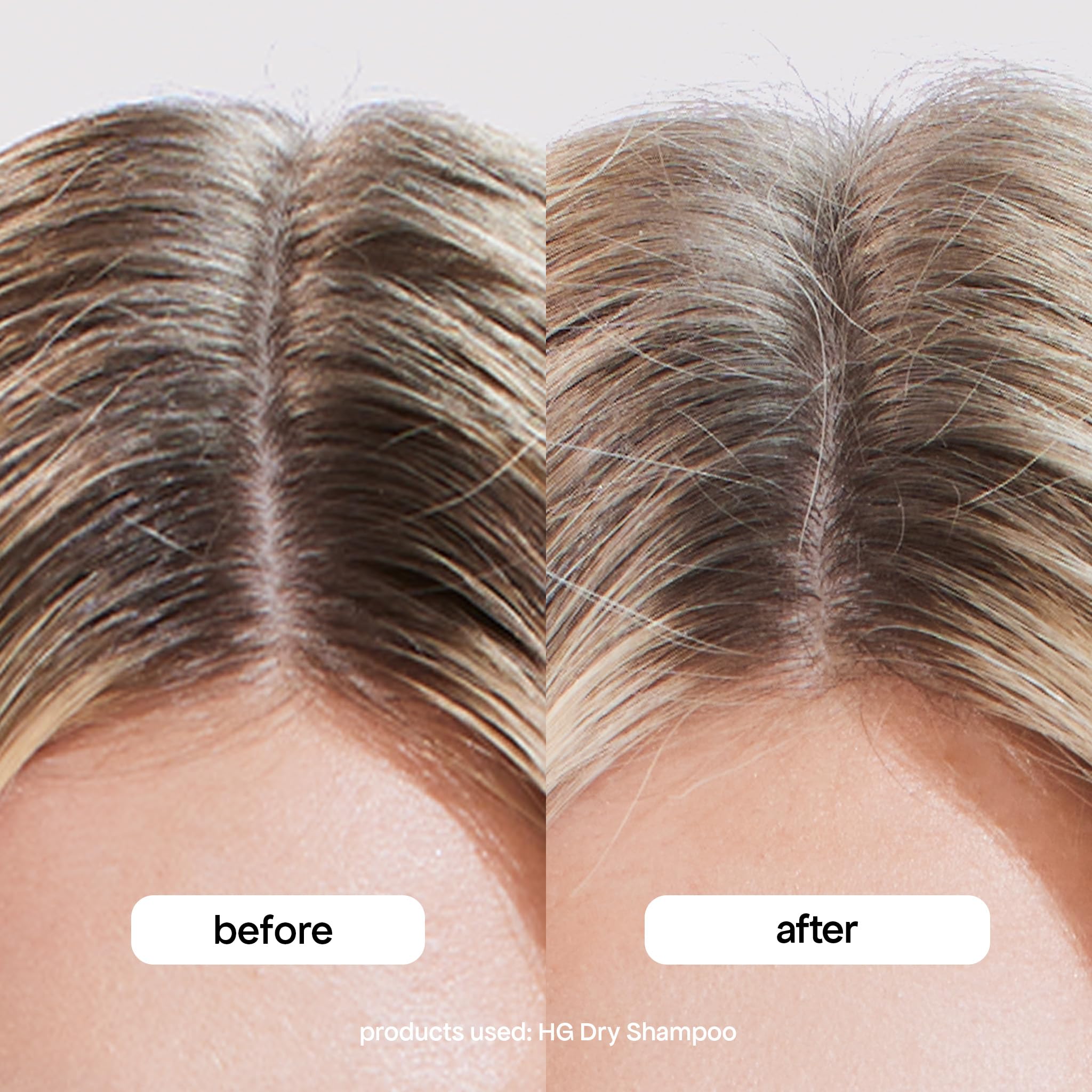 BondiBoost HG Dry Shampoo packaging highlights suitability for all hair types.