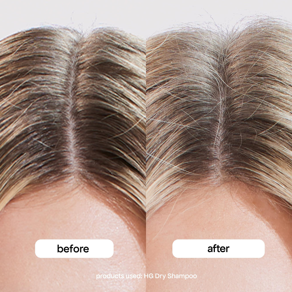 BondiBoost HG Dry Shampoo packaging highlights suitability for all hair types.