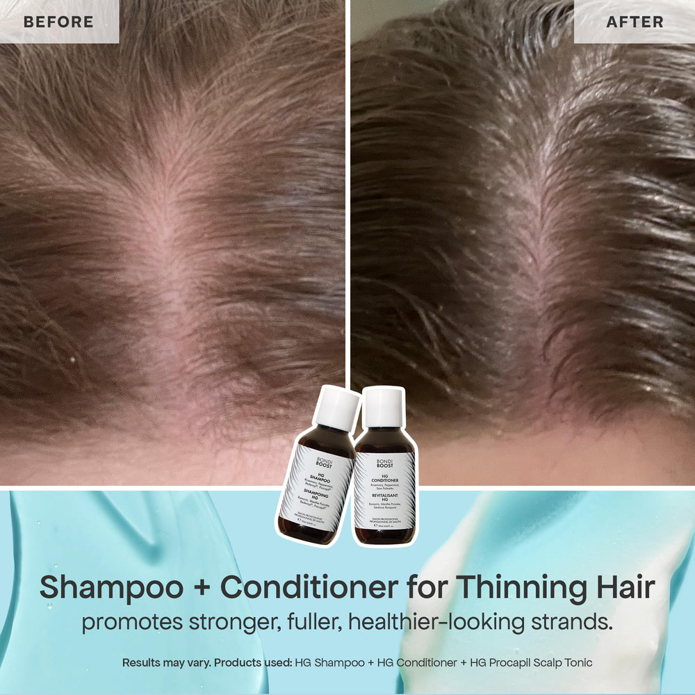 BondiBoost Lock Drops dropper delivering precise serum for targeted scalp support