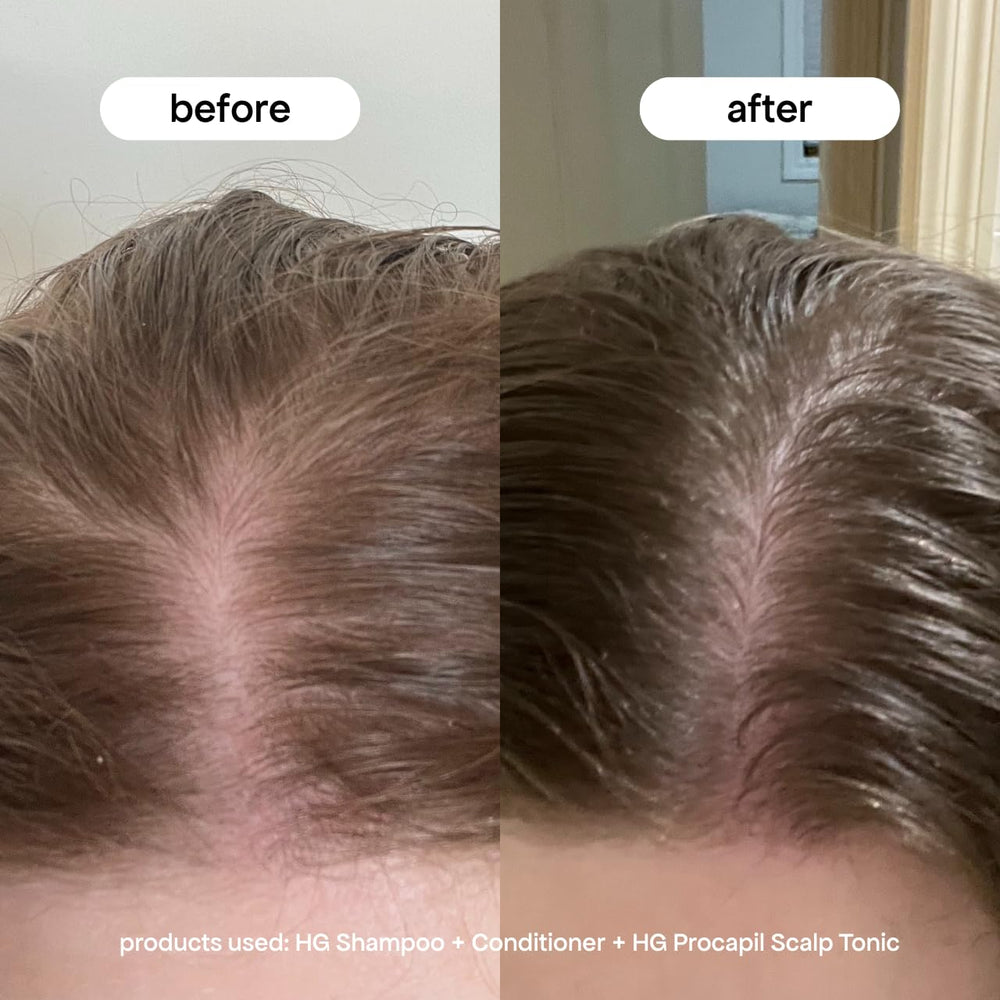 BONDIBOOST Procapil applicator tip enables easy, mess-free scalp treatment.