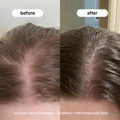 BONDIBOOST Procapil applicator tip enables easy, mess-free scalp treatment.