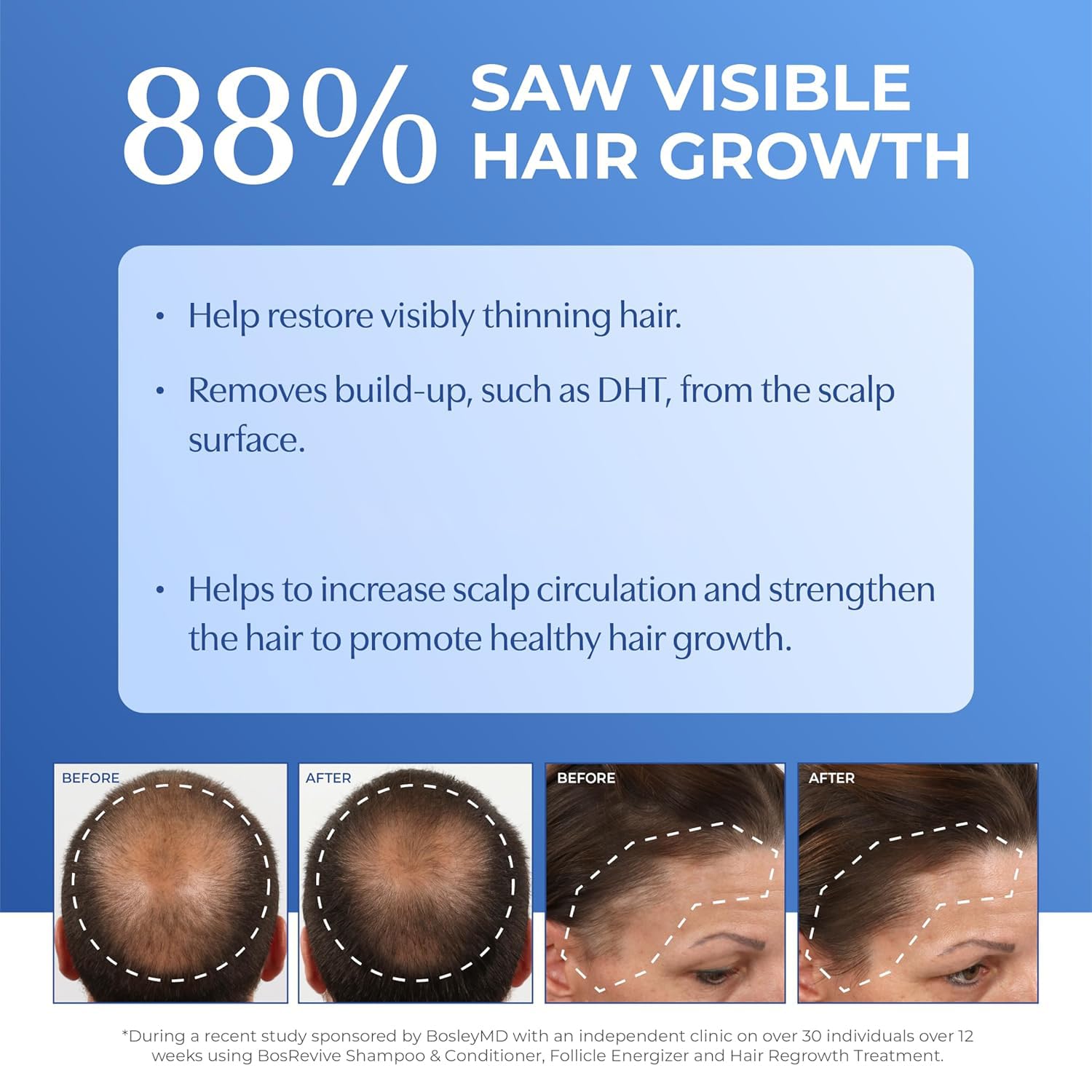 BosleyMD BosRevive hair-strands close-up suggesting strengthened strands and added volume