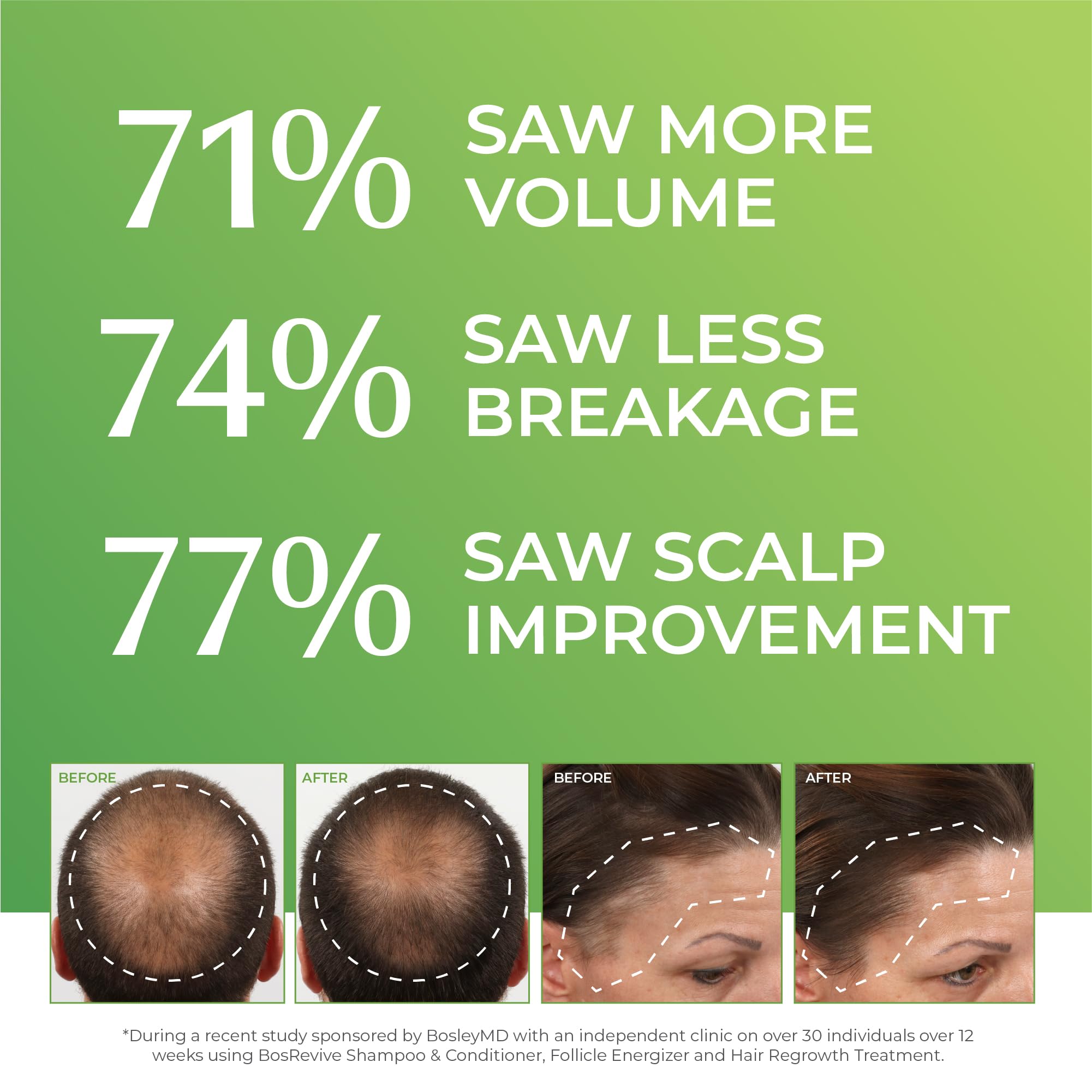 BosleyMD Healthy Hair Apple Stem Cell boosts follicle resilience.