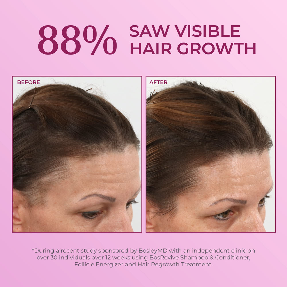 BosleyMD Minoxidil Woman Spray two bottles indicate consistent 60-day supply.