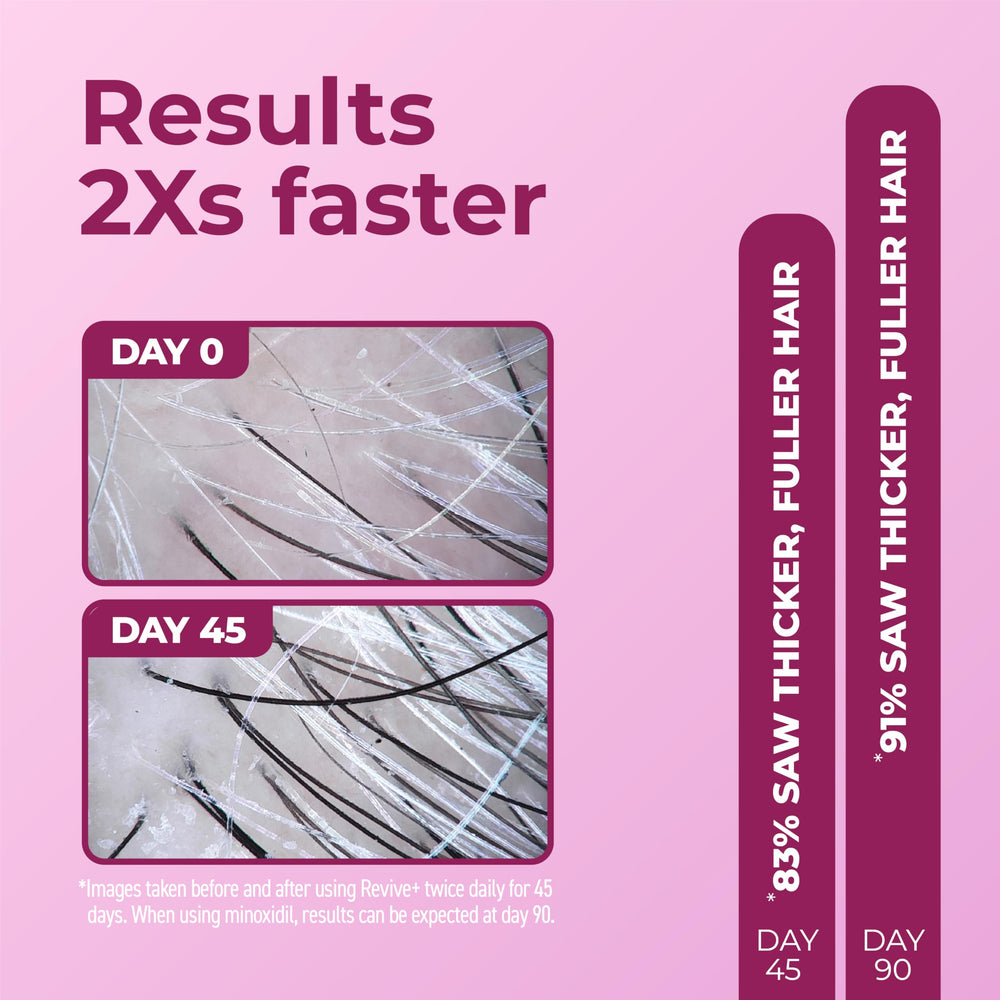 BosleyMD Revive+ vial open ready for fast-absorbing daily use on scalp