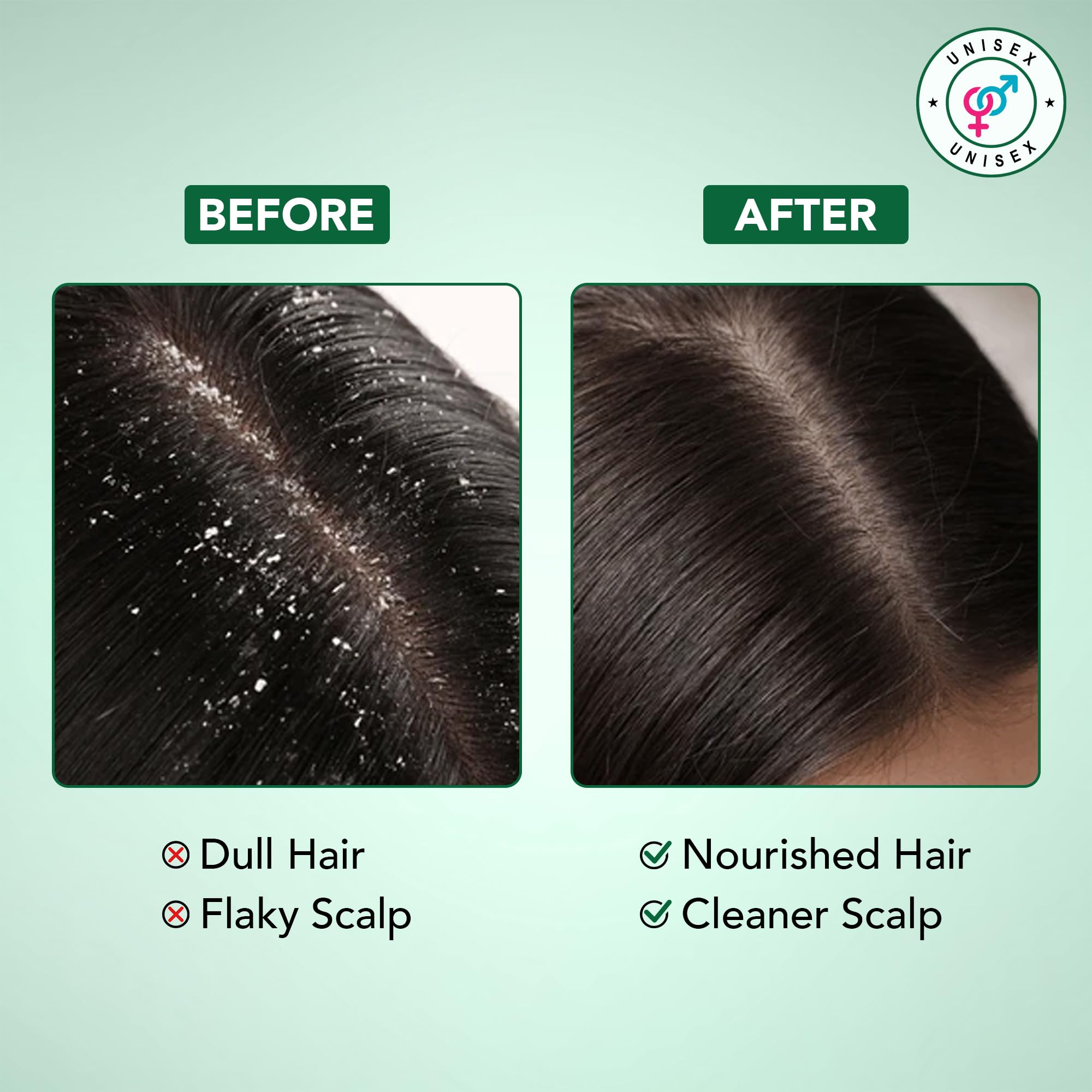 Botanic Hearth Tea Tree Mint splash conveys cooling sensation for scalp relief.
