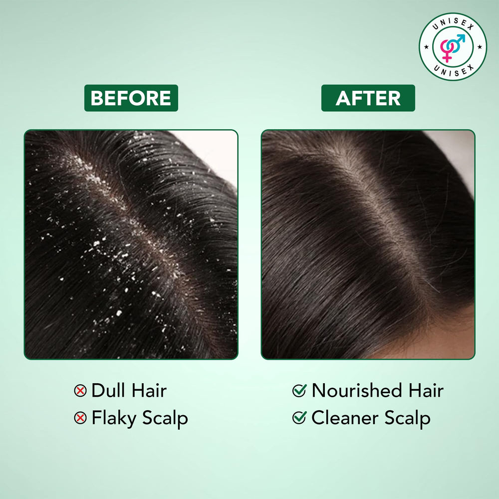 Botanic Hearth Tea Tree Mint splash conveys cooling sensation for scalp relief.