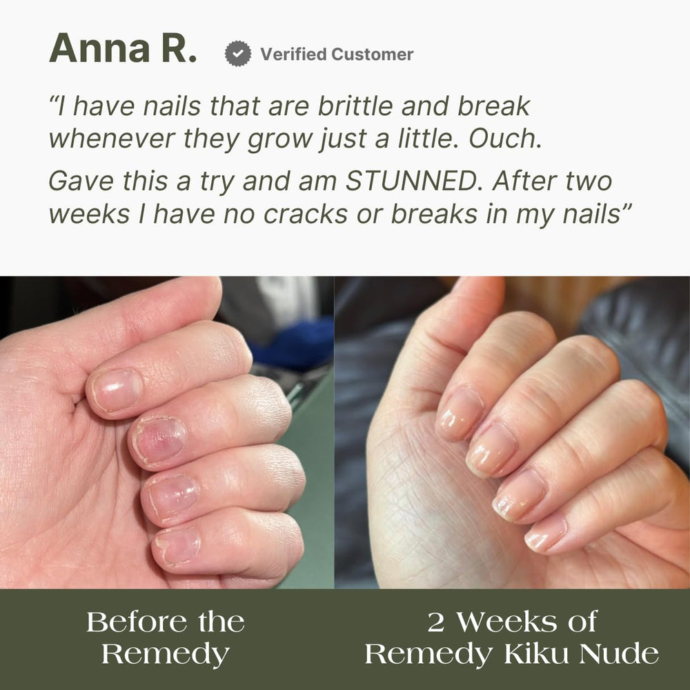 Botanist Nails The Remedy plant-based ingredients graphic highlights Squalene and Olive Oil