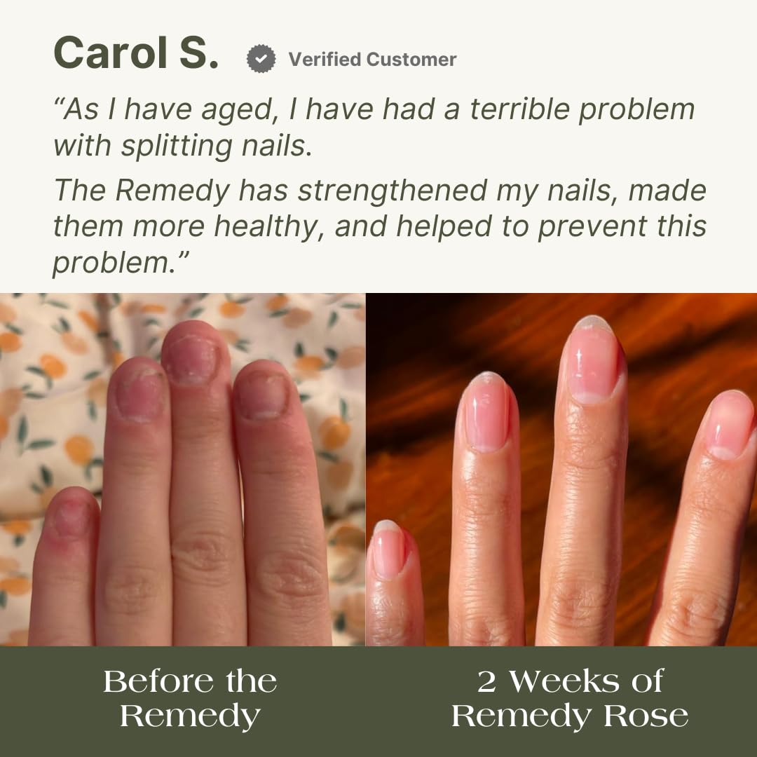 Botanist Nails The Remedy rose glow image emphasizes long-wear potential