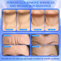 BOYAO silicone material closeup emphasizes hypoallergenic, skin-friendly wear for sensitive skin.