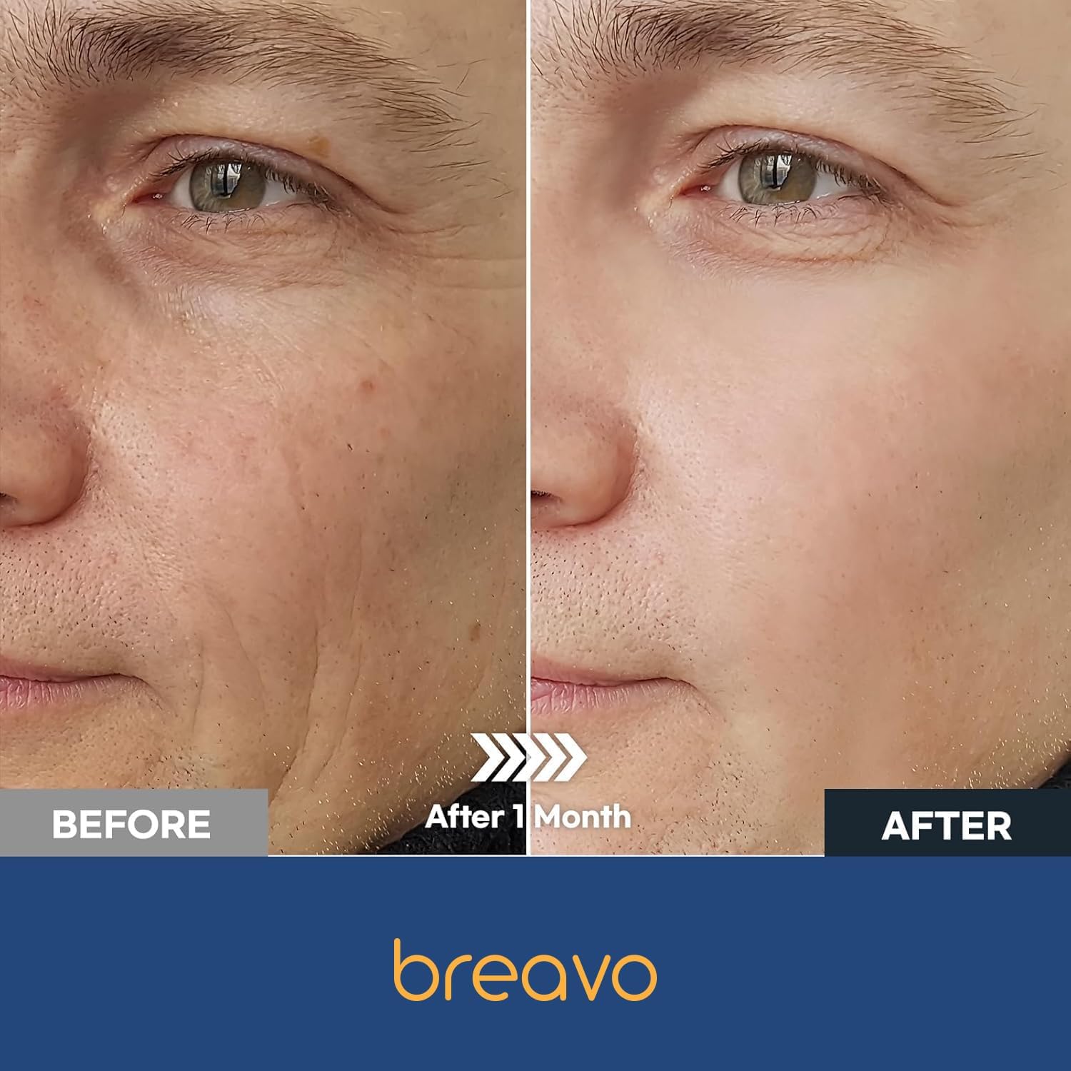 Breavo 6-in-1 face cream after shaving soothing and calming irritated skin.
