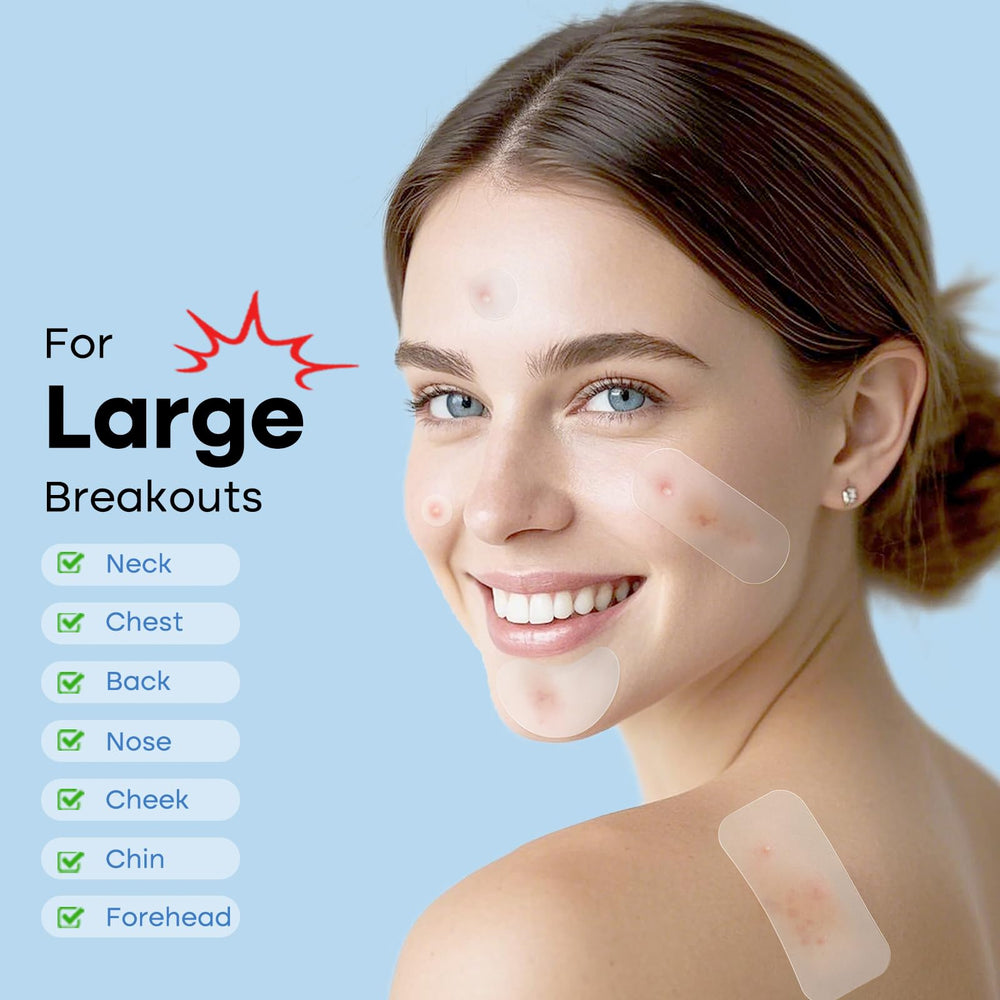 Breiboz xl acne patches on face close-up highlights strong adhesion for all-day wear.