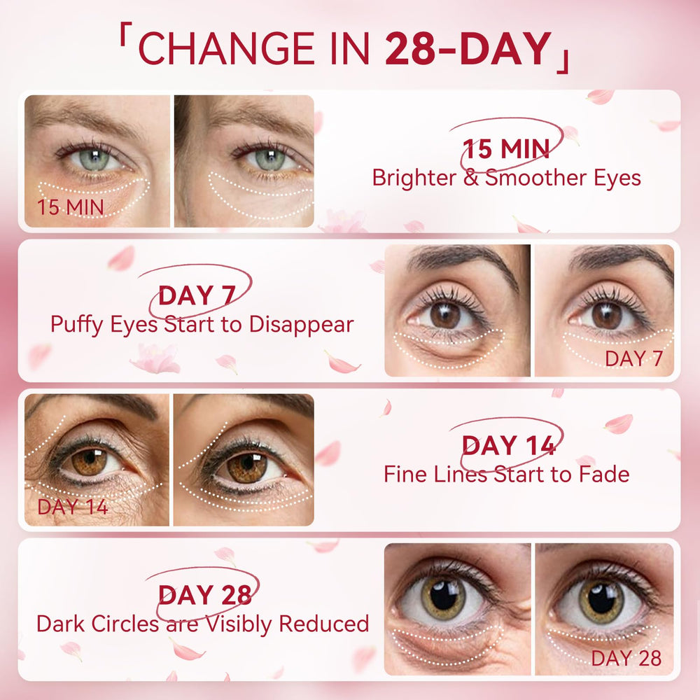 BREYLEE eye-mask grid design keeps patches in place.