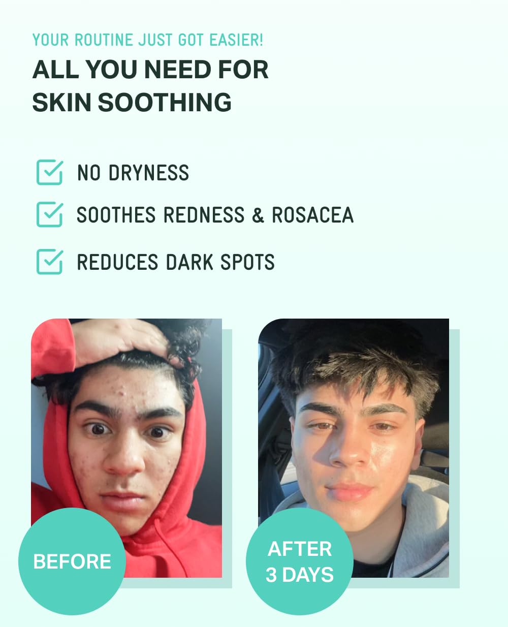 BRING GREEN Niacinamide Serum detail hints at smoother pores and even texture