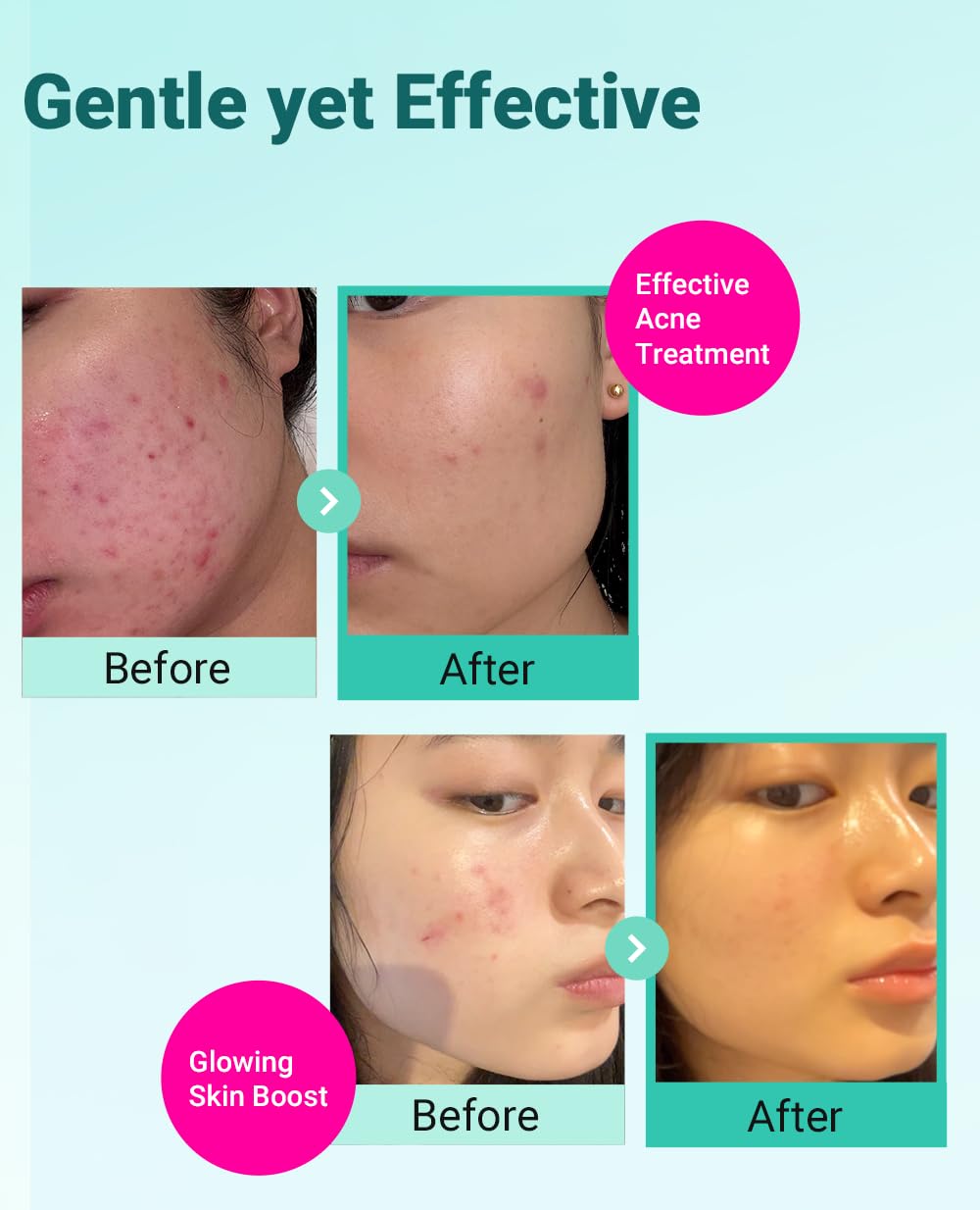 BRING GREEN Tea Tree Cica Cream hydrates without greasiness