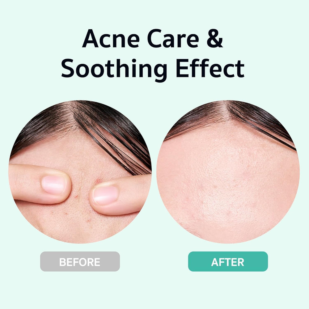 BRING GREEN Zinc Teca Serum pump dispensing for controlled application