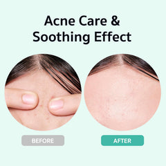 BRING GREEN Zinc Teca Serum pump dispensing for controlled application
