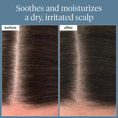 Briogeo Rosemary Pre-Wash Oil drops on fingertips demonstrating precise scalp application