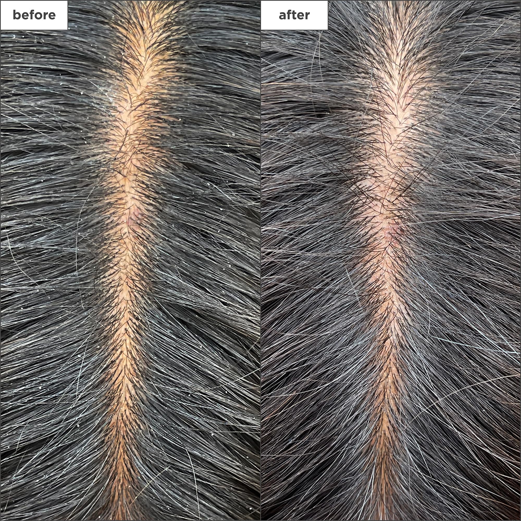 Briogeo Scalp Revival charcoal detail highlights detoxifying charcoal with mint cooling.