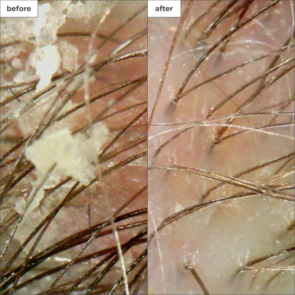 Briogeo Scalp Revival coconut oil moisturizing layer image emphasizing scalp hydration