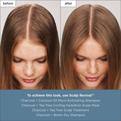 Briogeo Scalp Revival peppermint cooling note suggests instant comfort on contact