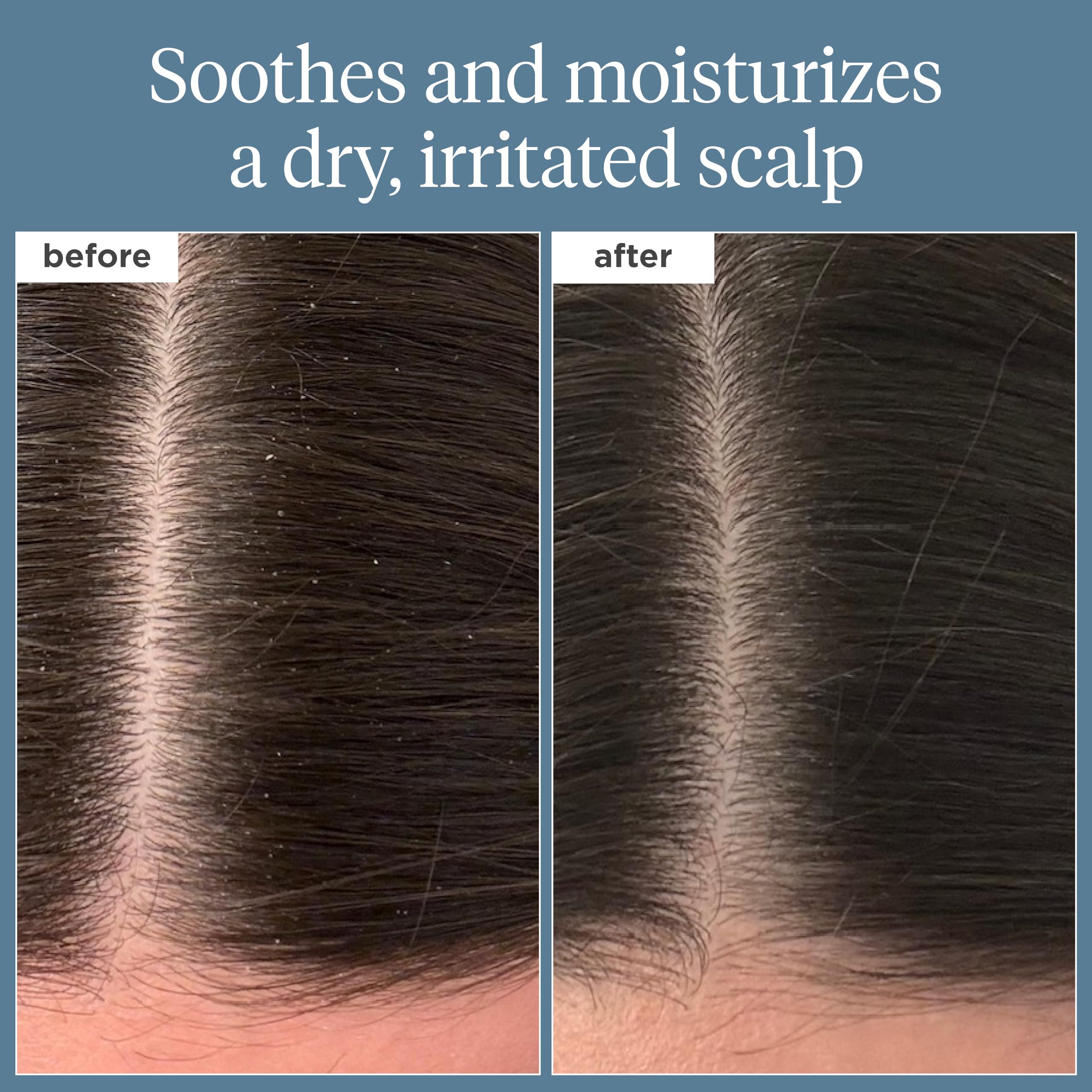 Briogeo Scalp Revival rosemary oil drop highlighting nourishing oil benefits