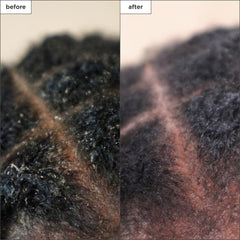 Briogeo Scalp Revival tea tree drops emphasize cooling relief for itchy scalp