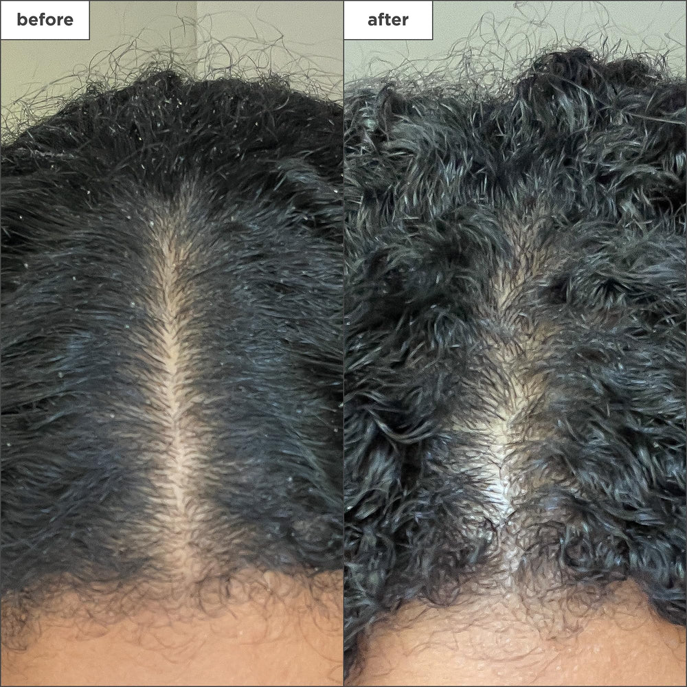 Briogeo Scalp Revival tea-tree-mint blend signals cooling, soothing scalp.