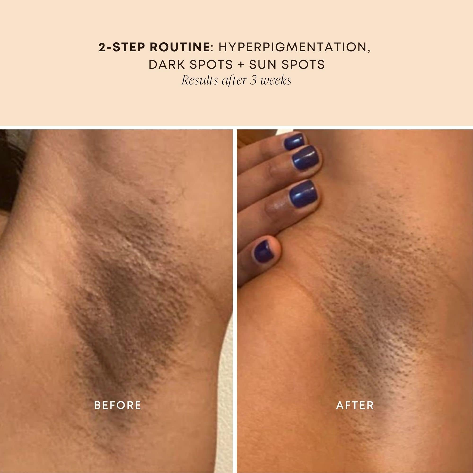 Bushbalm Bermuda Oil near underarms demonstrates calming skincare routine.
